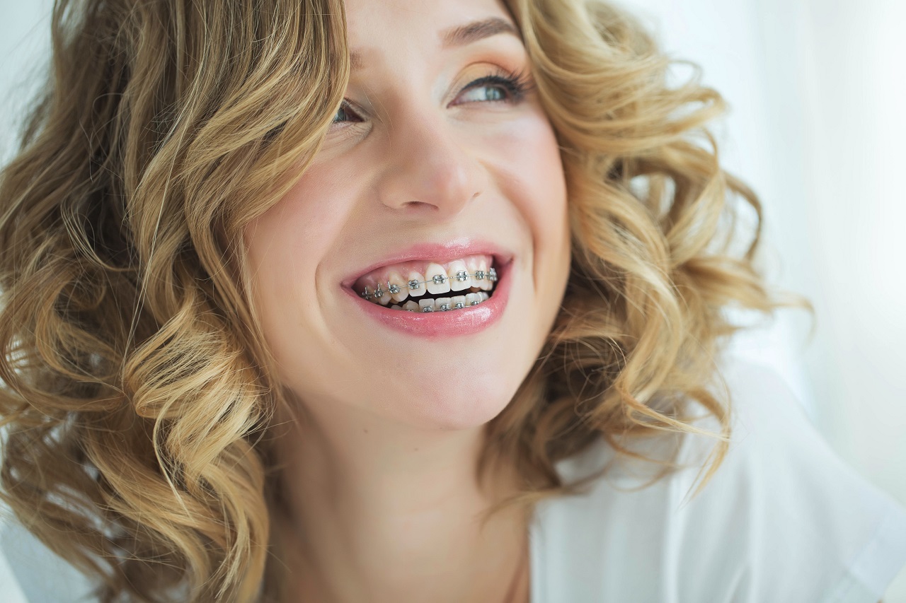 Typy aparatów ortodontycznych – podobieństwa i różnice